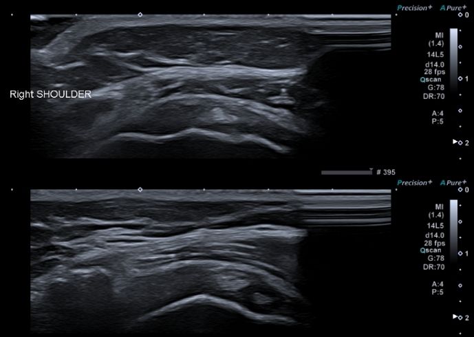 ecografia-osteoarticular