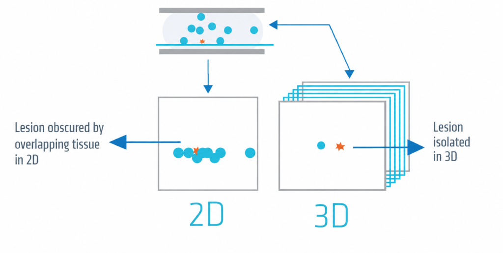 difference between 2D and 3D mammography